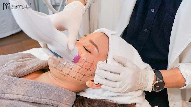 Công nghệ Thermage FLX được các chuyên gia cho là an toàn và hiệu quả