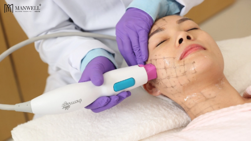 Thermage FLX là công nghệ trẻ hoá xoá nhăn thế hệ thứ 4 sử dụng sóng RF tác động nhiệt sâu dưới da để tăng sinh collagen 