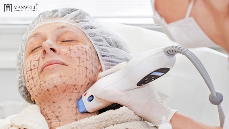 Thermage FLX có thể trẻ hoá vùng mặt, cổ, tay. chân,...