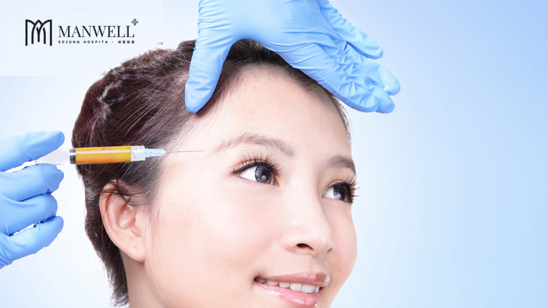 Cấy mỡ tự thân vào vùng thái dương