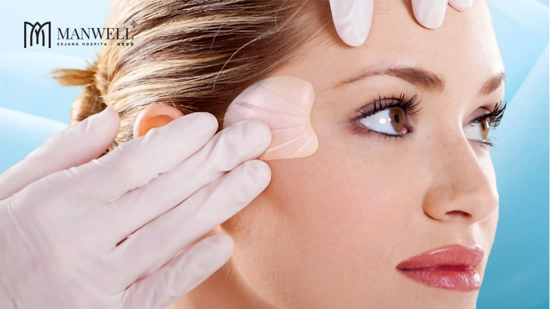 Độn silicon thái dương