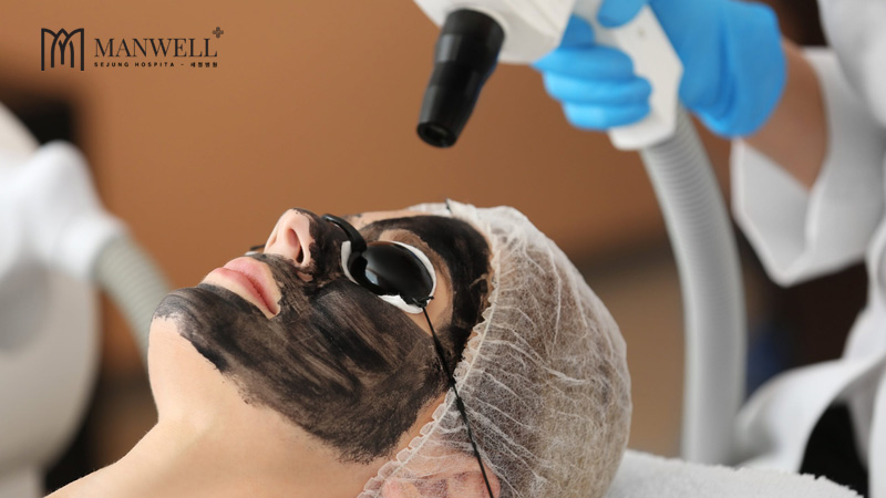 Bắn carbon trẻ hoá da là một phương pháp thẩm mỹ với nhiều ưu điểm