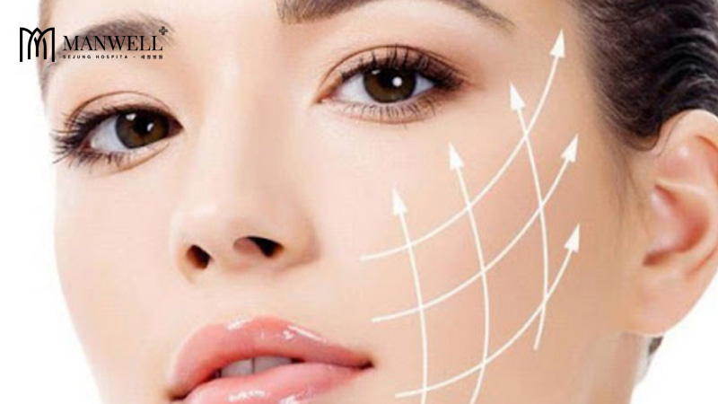 Chi phí căng chỉ da mặt hiện nay khoảng từ 50 triệu đồng