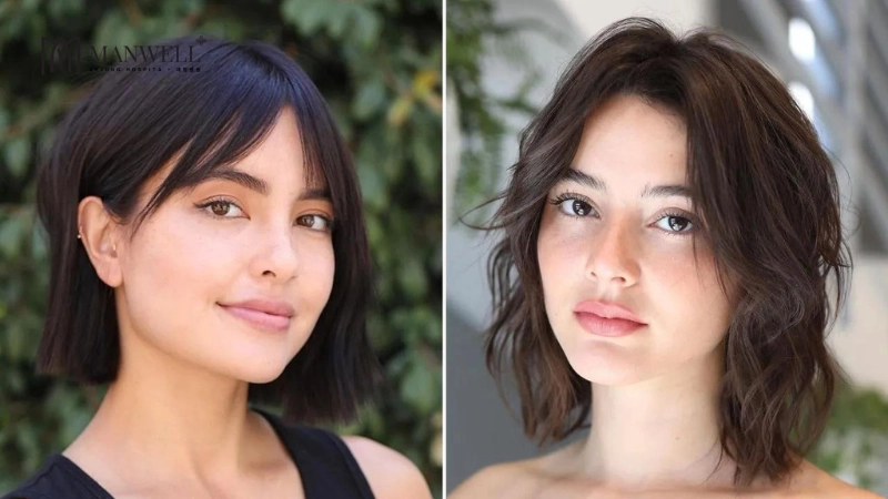 Kết quả của cấy mỡ má hóp