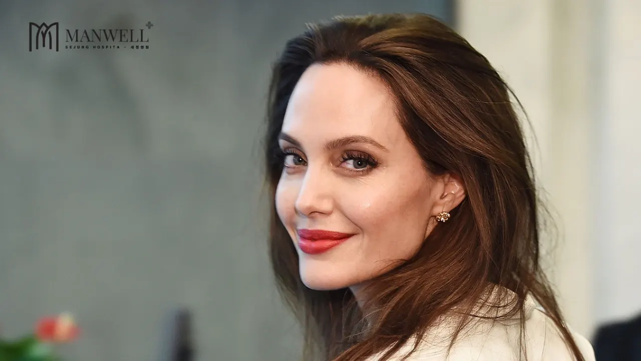 Gò má như thế nào ở phụ nữ được gọi là gò má cao?