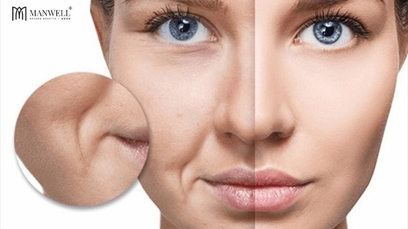 Ít biểu cảm "quá đà" trên gương mặt như cười quá to, nhăn mặt, nheo mắt....