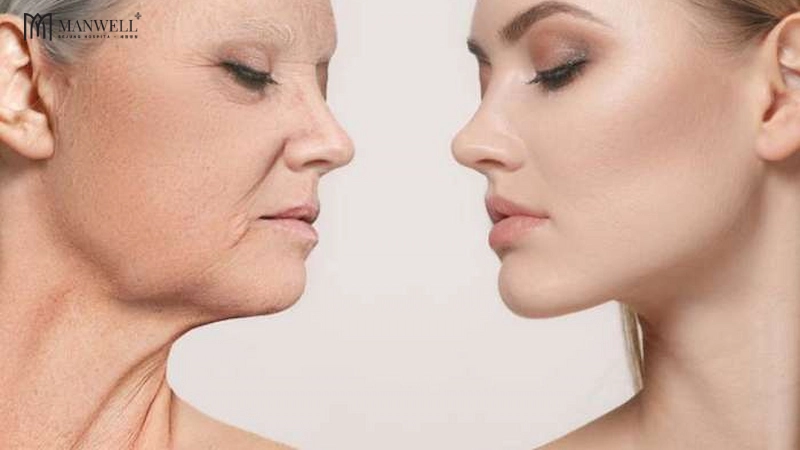 Lão hoá da là khi xuất hiện các dấu hiệu nhăn nheo, đồi mồi, vết chân chim....trên da