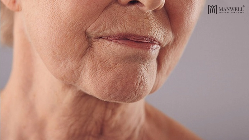 Lão hoá nội sinh và tác động ngoại cảnh là 2 yếu tố chủ yếu khiến da mặt chùng nhão