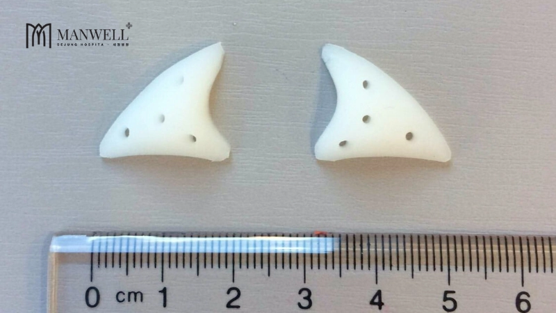 Hình dáng miếng silicon dùng để độn rãnh cười