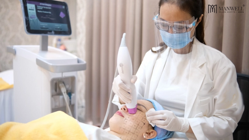 Công nghệ Thermage FLX sử dụng năng lượng sóng điện từ để kích thích sản sinh collagen làm săn chắc và nâng cơ vùng da quanh mắt.