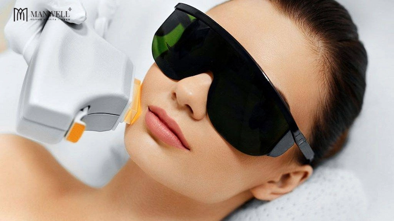 Công nghệ IPL sử dụng các ánh sáng xung cường độ cao để giải quyết vấn đề về sắc tố và mạch máu trên da.