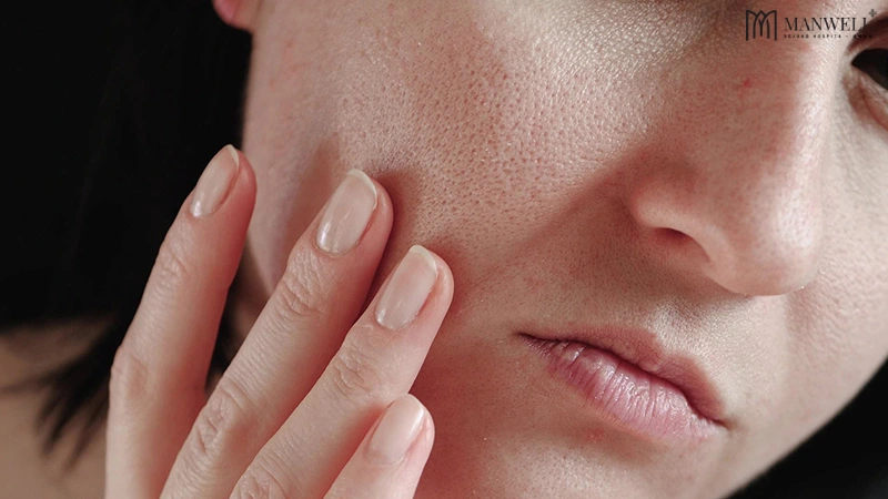 Những người có làn da khô, bong tróc, nhăn nheo, chảy xệ,... có thể tiêm meso căng bóng da