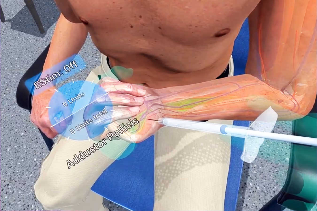 Infuse Medical Gallery Image 6