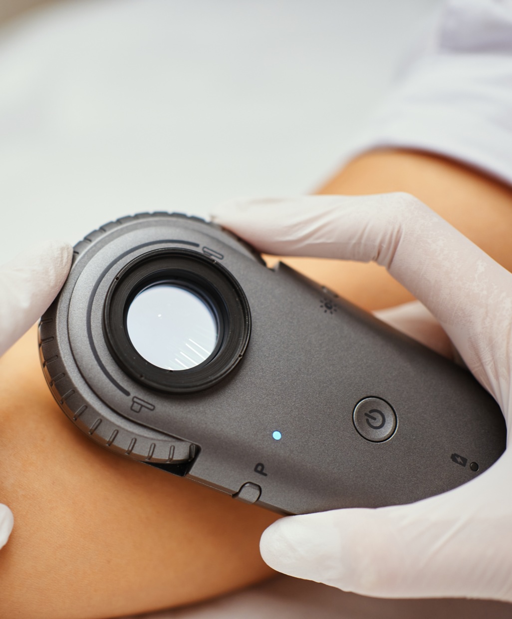 Dermatology equipment