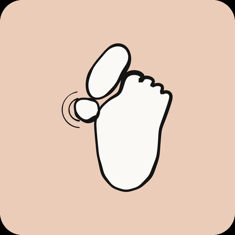 Illustration d'un pied avec gros orteil dévié et douleur, guide Hallux Valgus en physiothérapie Physioactif