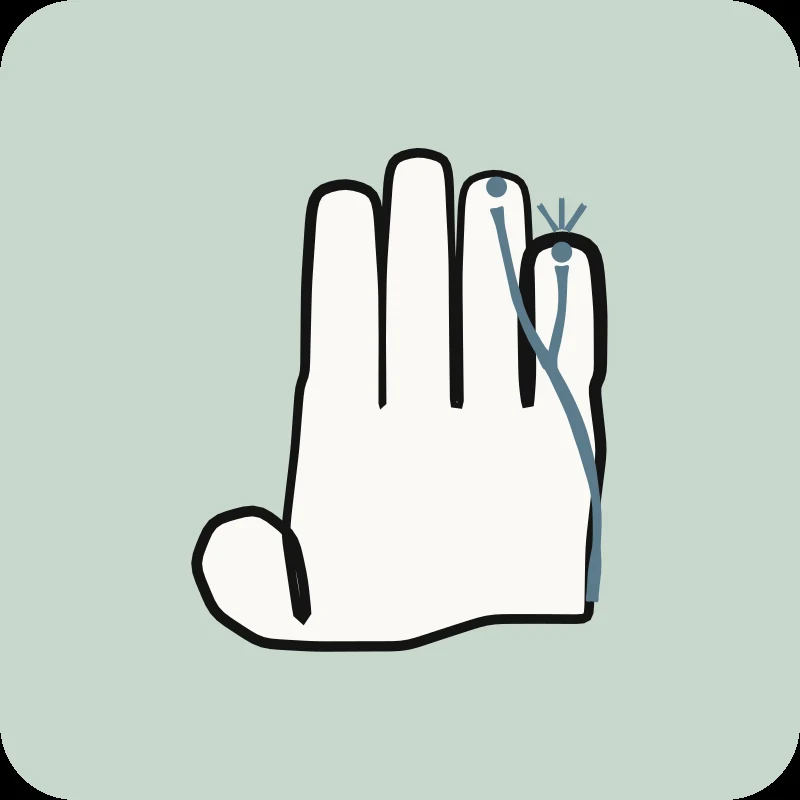 Illustration d'une main avec le nerf ulnaire bleu vers l'auriculaire, guide Syndrome du canal de Guyon en physiothérapie Physioactif