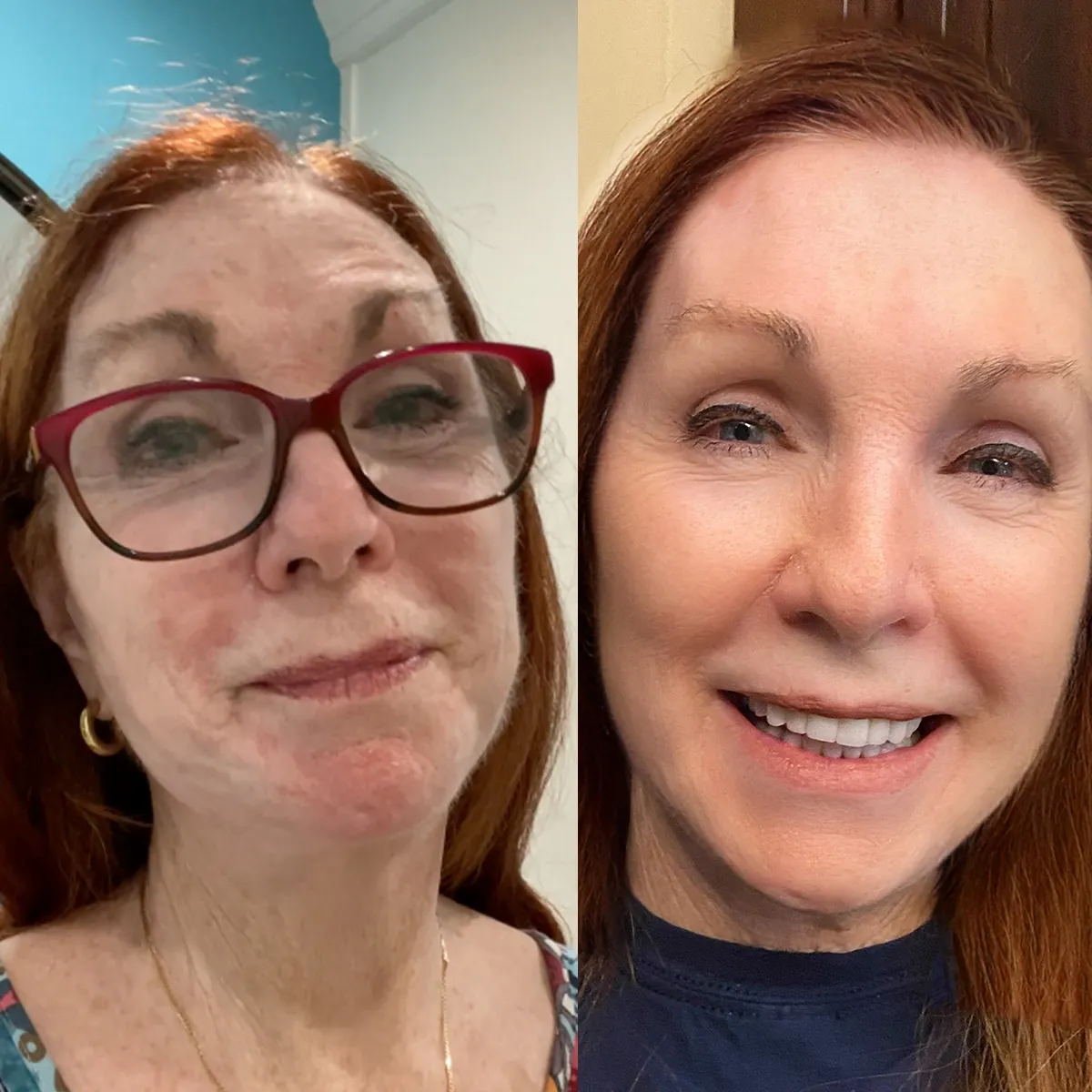 Effect-on-day-7-after-using