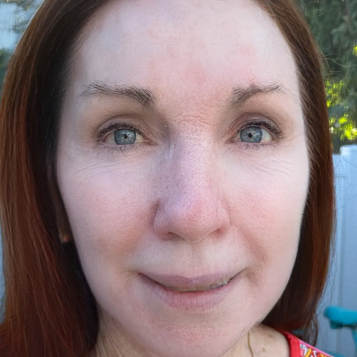 Fades-71%-of-dark-spots
