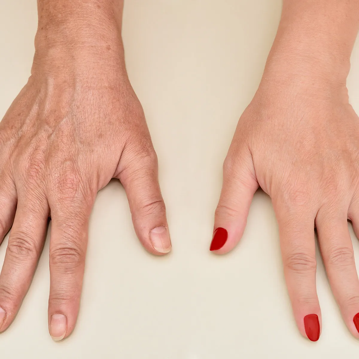 NO-PAIN-NO-LASERS-NO-SIGNS-OF-AGING