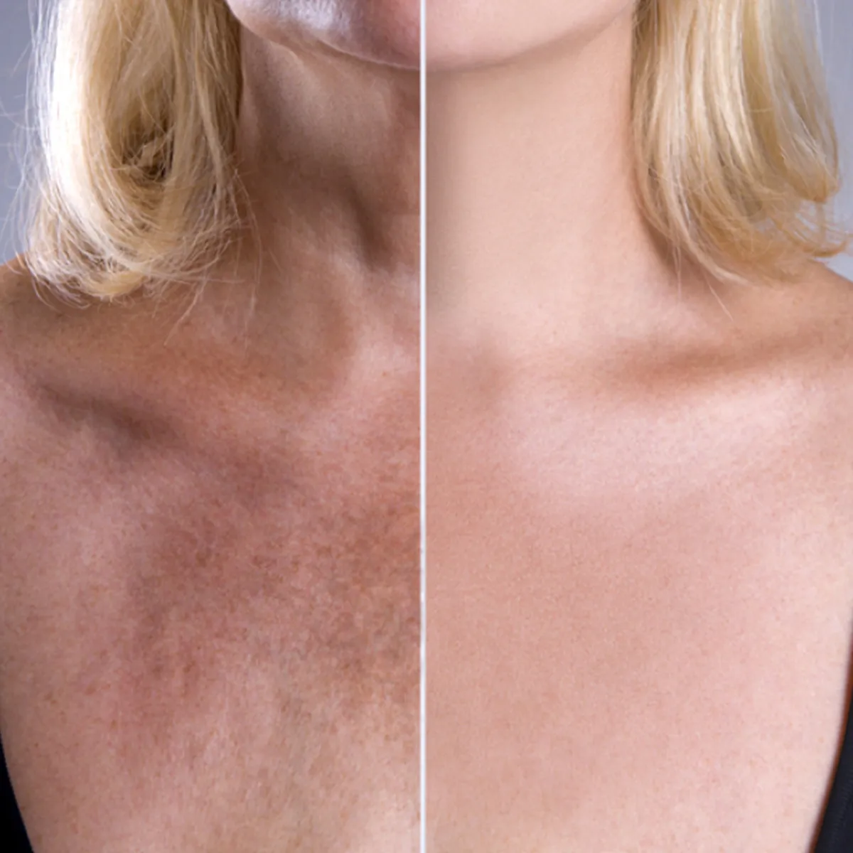 Maximum-skin-plumping