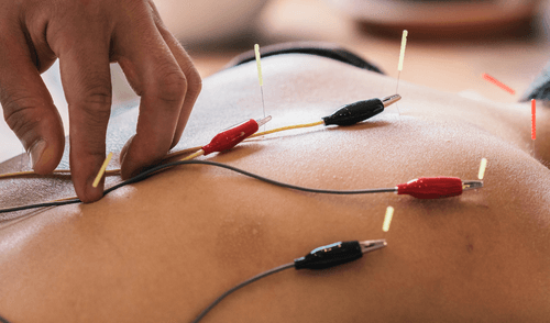 sports physical therapy san antonio