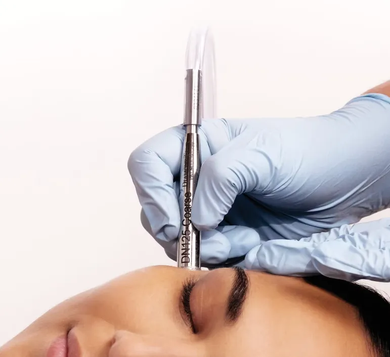 Diamond Microdermabrasion