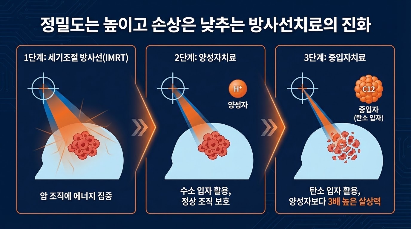세기조절 방사선치료와 중입자치료의 차이점을 설명하는 인포그래픽