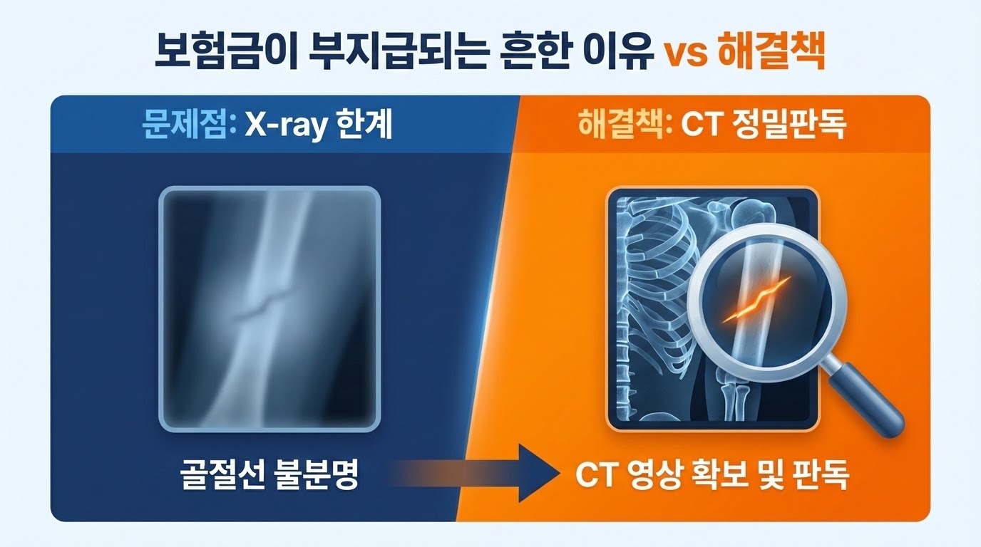 CT 정밀 검사를 통한 골절선 확인 과정