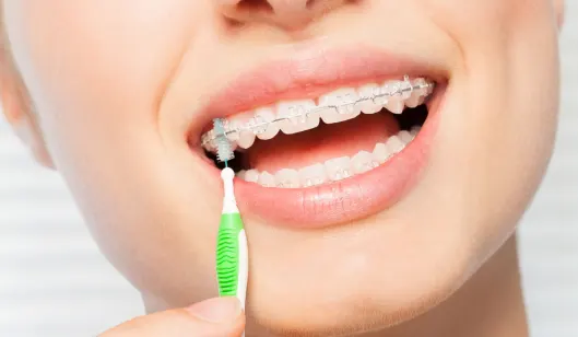 Dental Services in Renton, WA | SmileVibe Dentistry