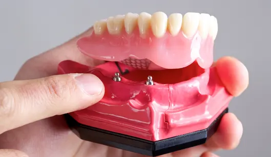 Dental Services in Renton, WA | SmileVibe Dentistry
