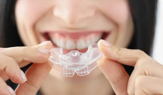 Dental Services in Renton, WA | SmileVibe Dentistry