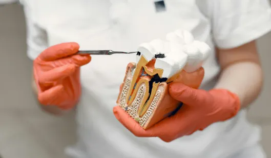 Dental Crowns in Renton, WA