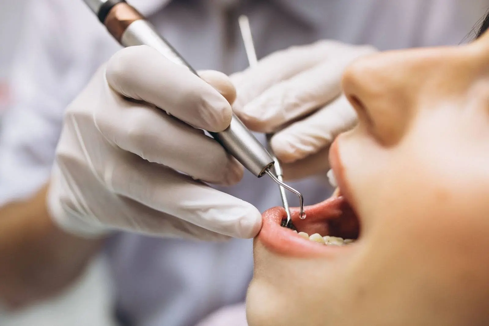 Should You Worry About Pain During Cavity Treatment?