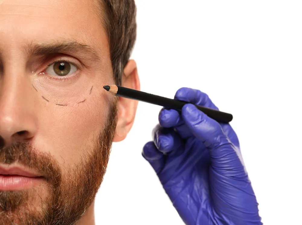 Male Blepharoplasty