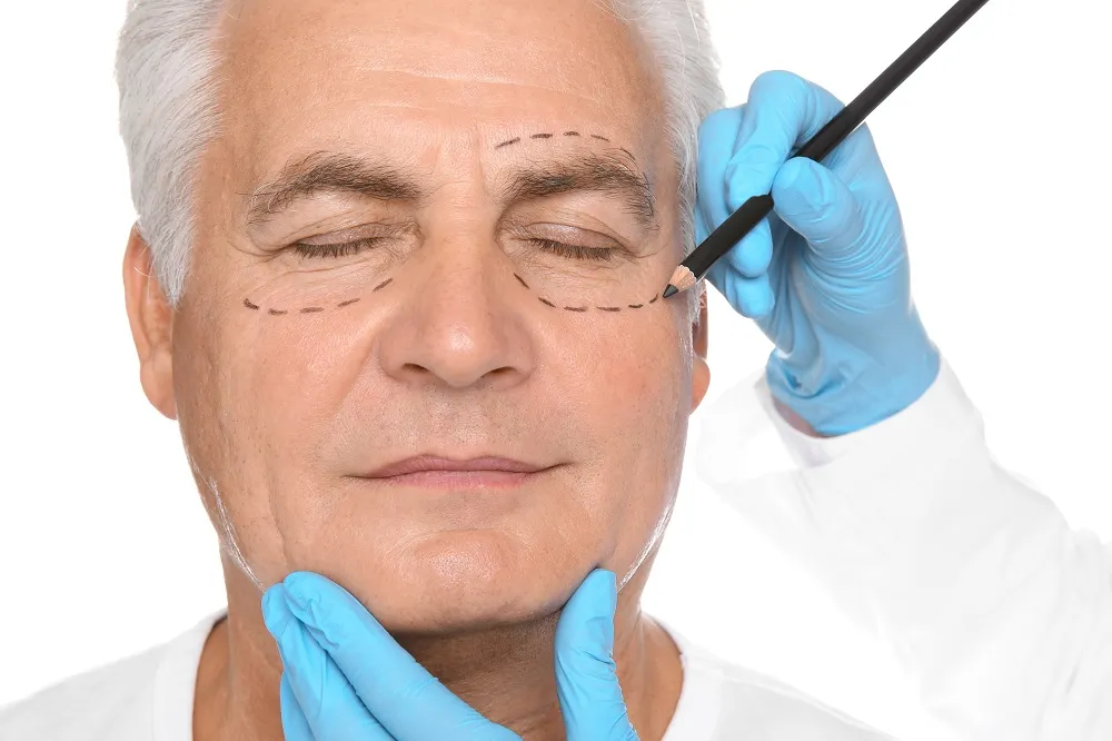 Male Blepharoplasty Procedure Chicago