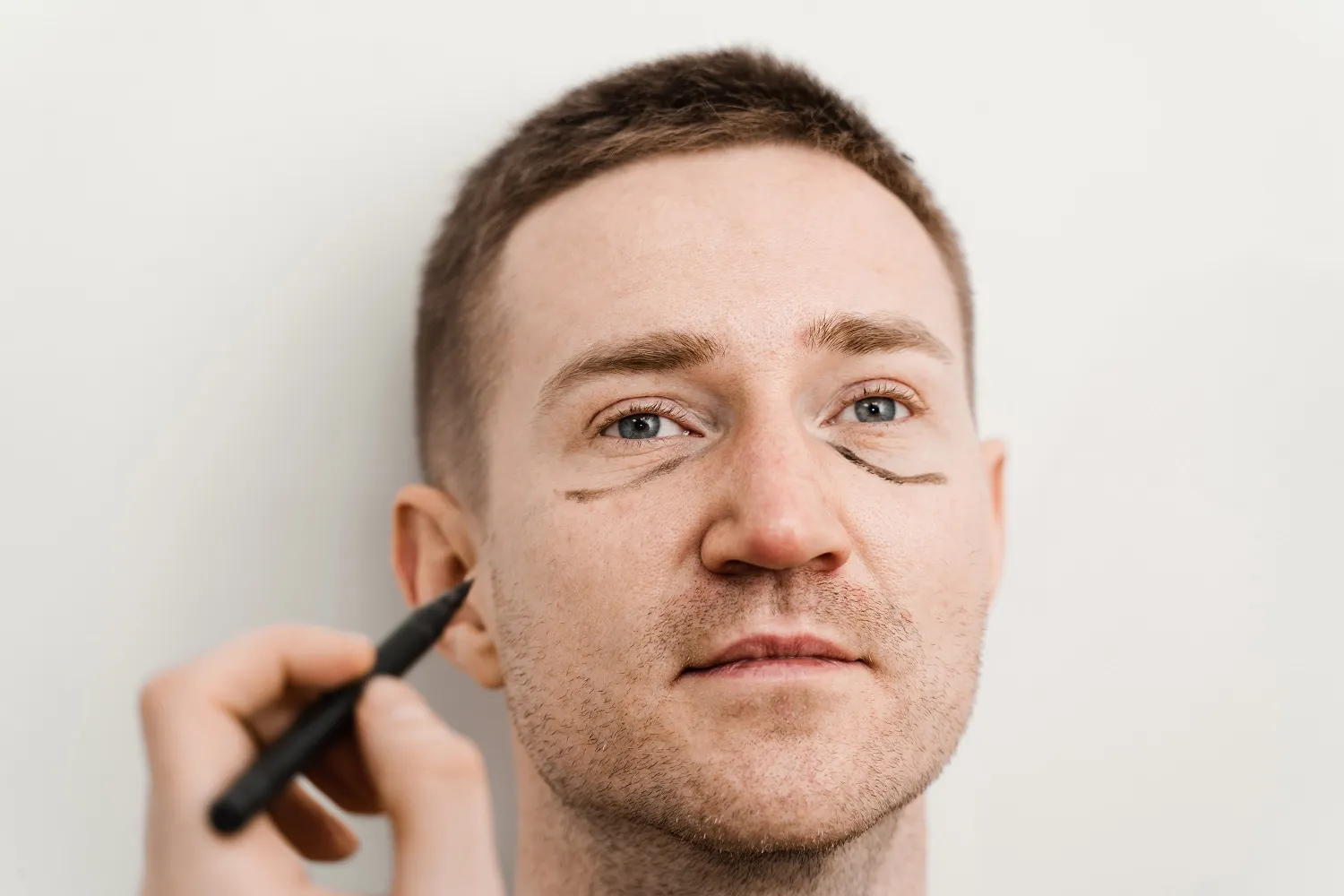 What Is Lower Eyelid Blepharoplasty