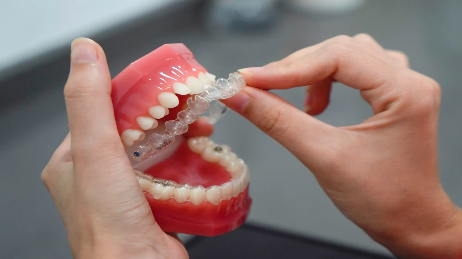 What to Expect at Your First Clear Aligner Consultation in East Brunswick [Guide]
