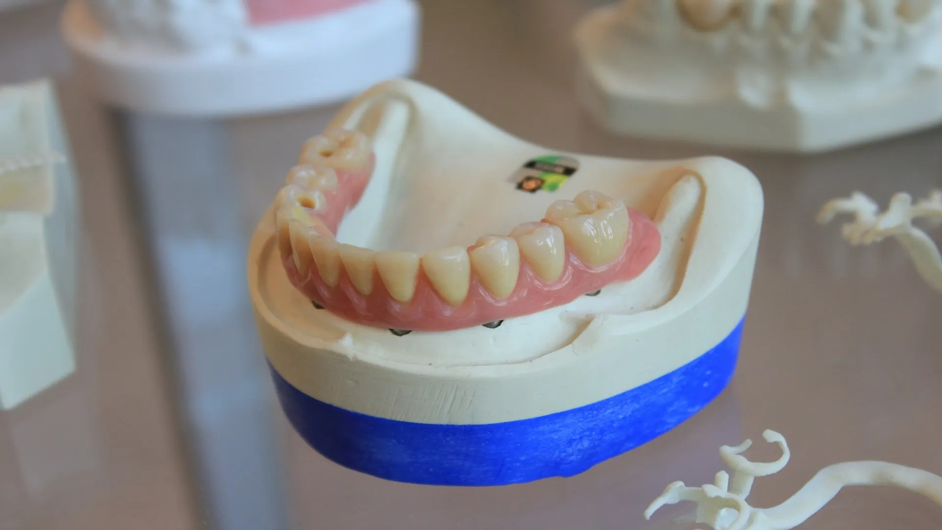 The Dental Implant Process in East Brunswick: What to Expect With Dr. Mantias