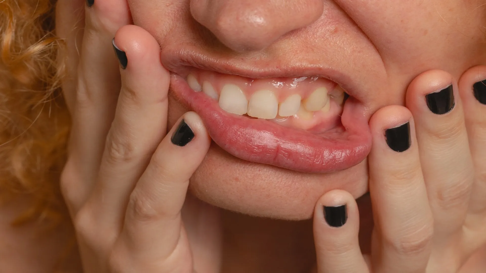 The Science Behind Teeth Discoloration: Causes and Fixes