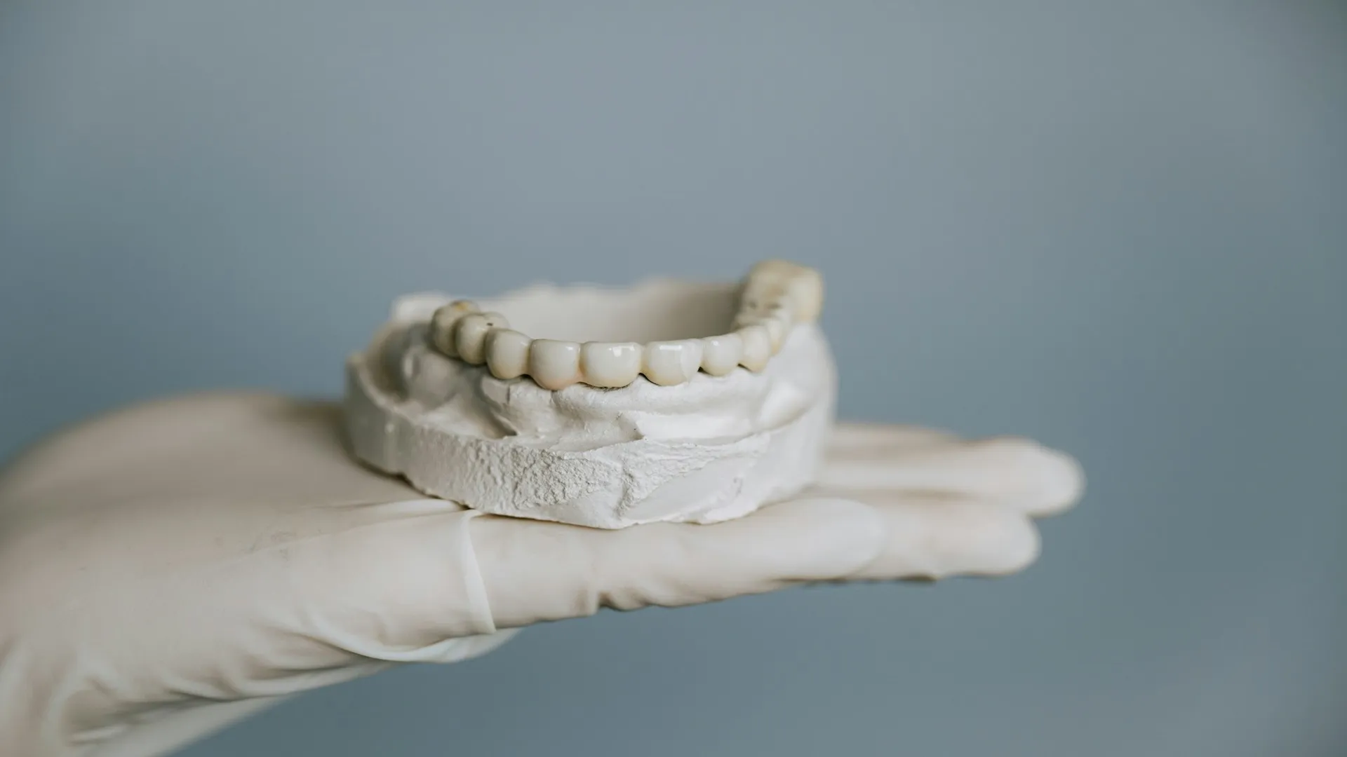 Debunking Common Myths About Dental Bridges (East Brunswick, NJ Guide)