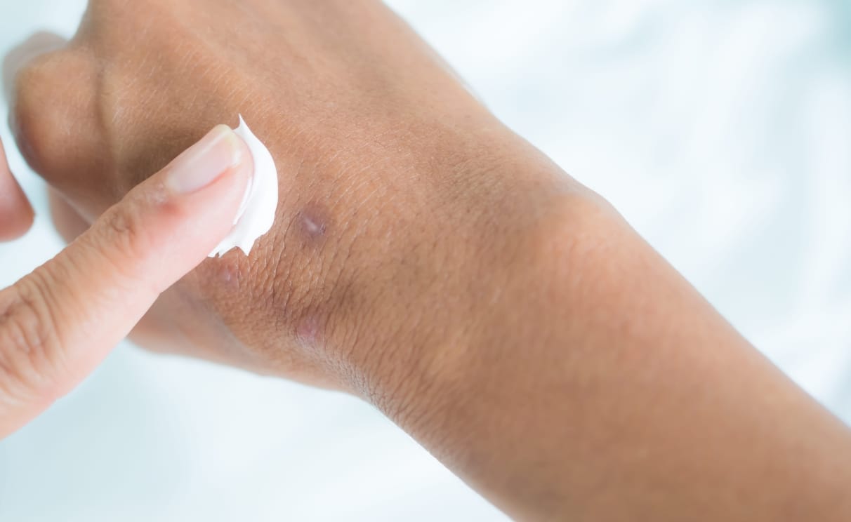 Medikamente Hautleiden