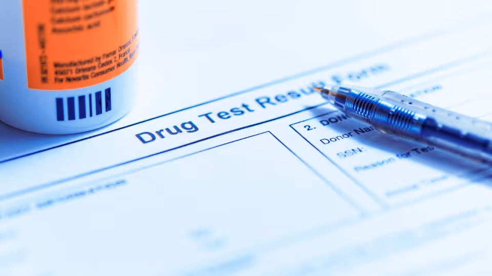 Can Your Employer Require Drug Testing?