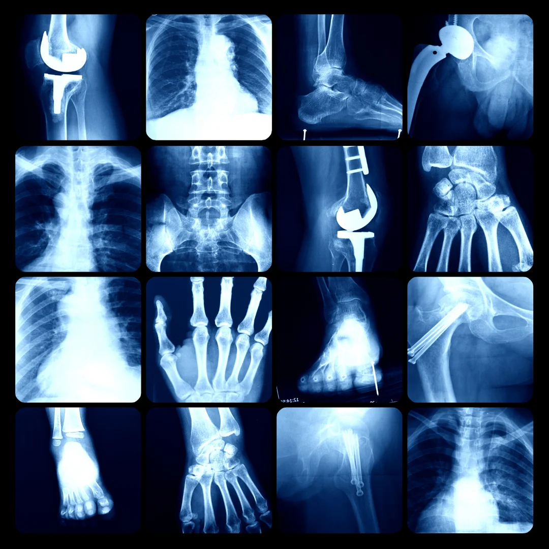 X - ray images of a person's arm and hand.