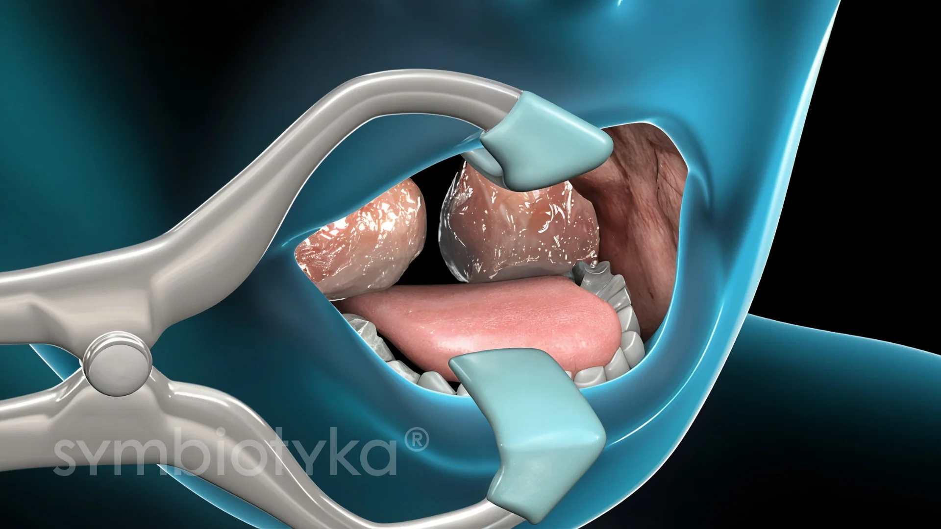 A medical illustration of the inside of a person's mouth.