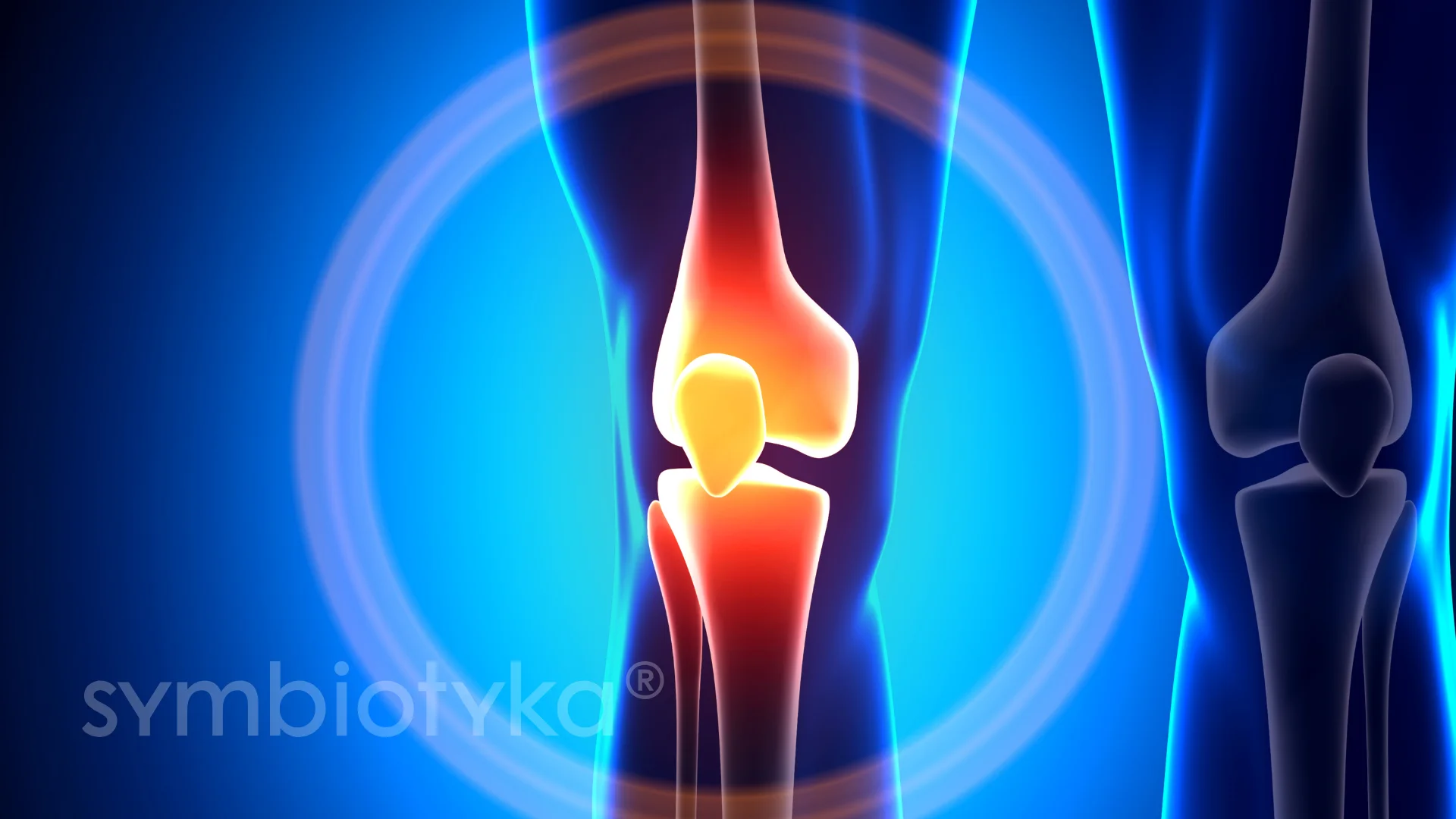 A medical illustration of a knee joint.