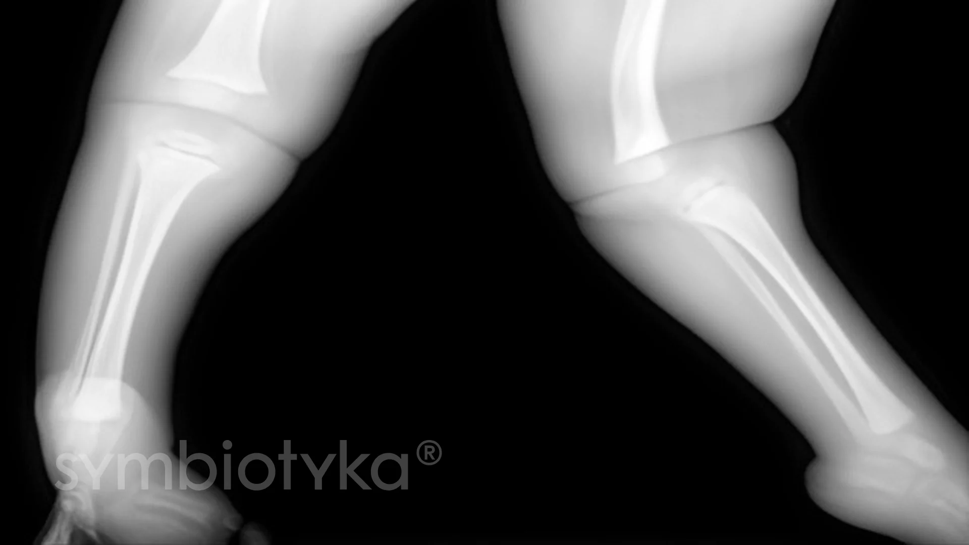 A black and white photo of a woman's legs.