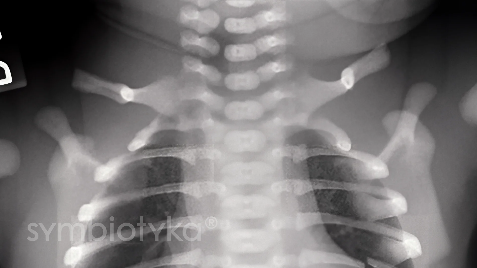 A black and white photo of a person holding a cell phone.