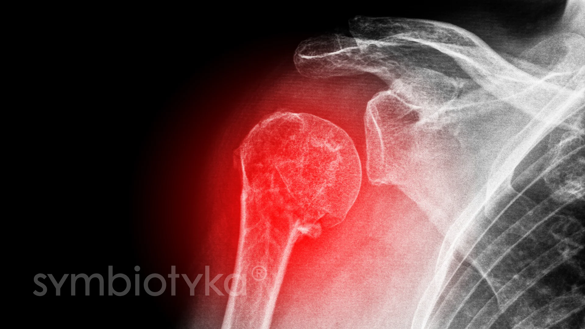 An x - ray image of a shoulder with a red spot.