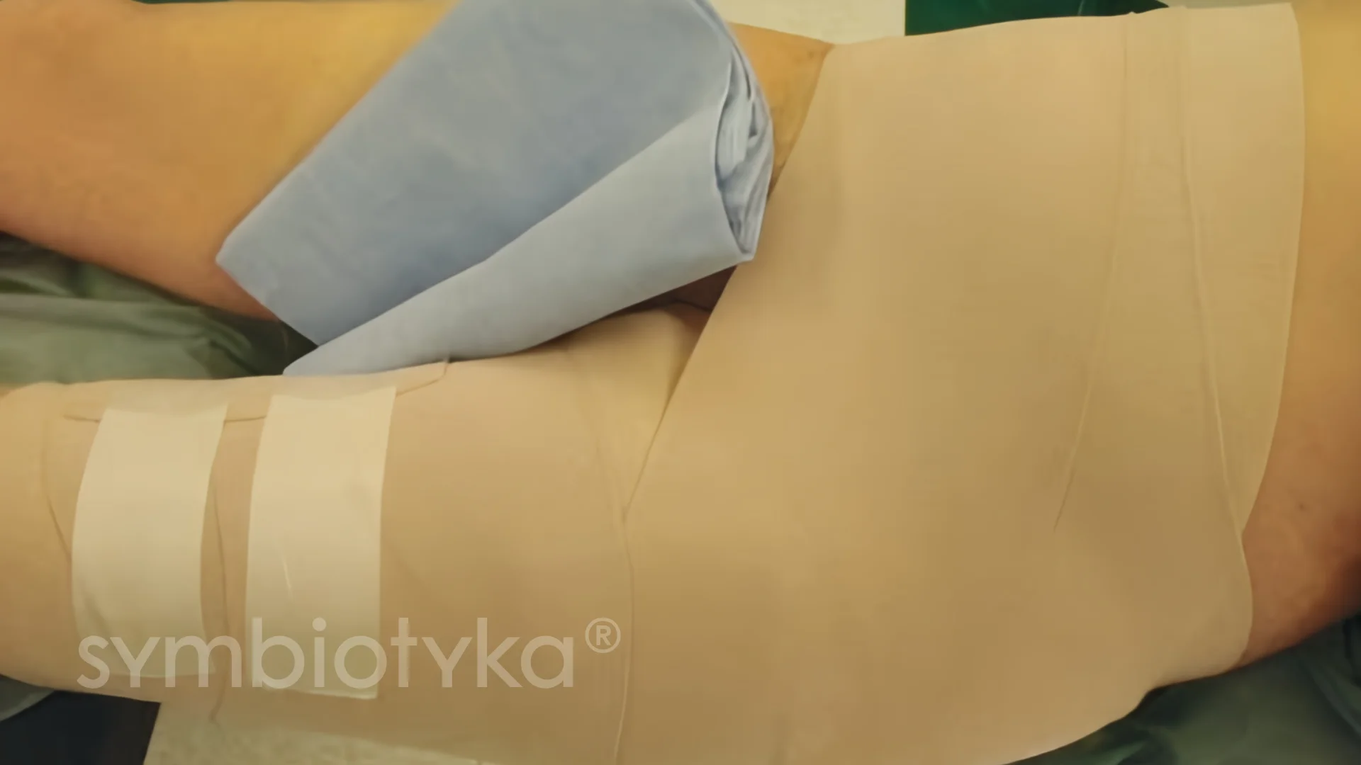 A close up of a person with a cast on his arm.