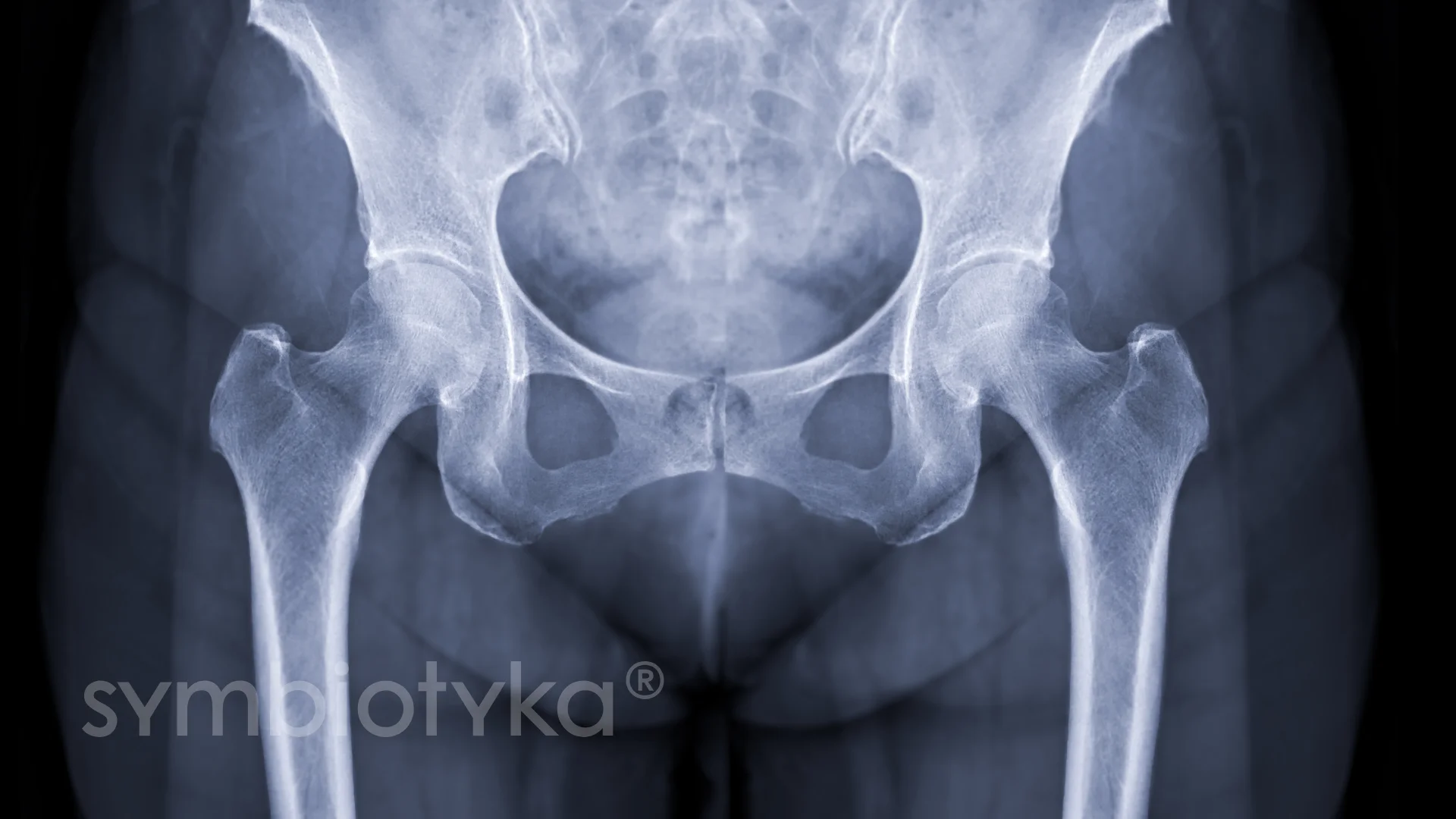 An x - ray image of a knee joint.kulsh
